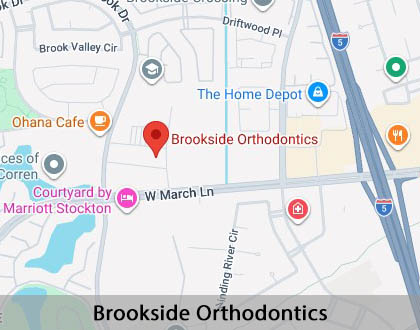 Map image for Retainers in Stockton, CA