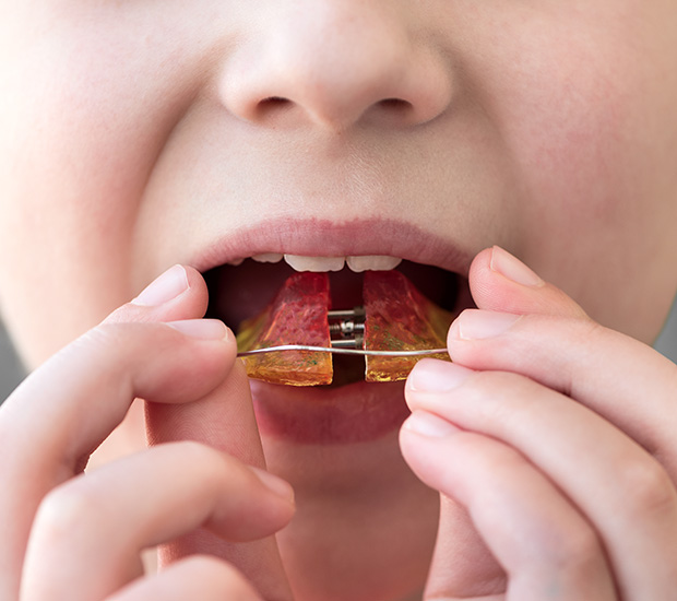 Stockton Phase One Orthodontics