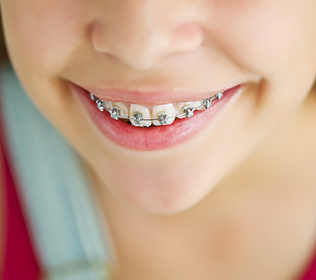 Stockton Phase Two Orthodontics